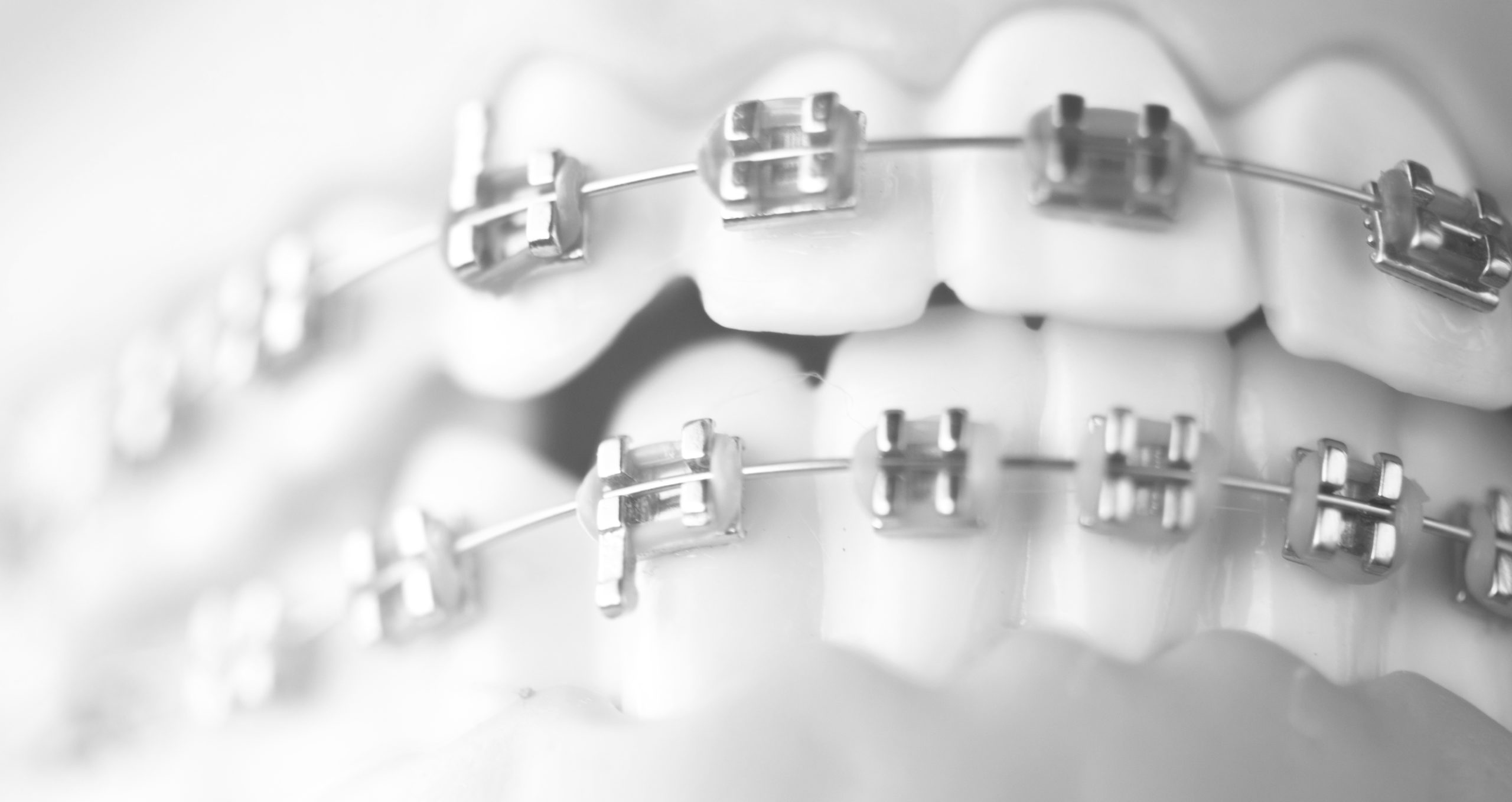 Read more about the article ORTHODONTIA HAS IT’S OWN ALLOWANCE NOW!